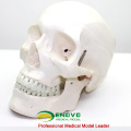 SKULL03 (12329) Medical Skull Anatomy Model for Patient Communication